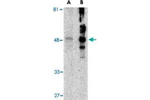 Western blot analysis of HAVCR1 in human uterus tissue lysate with HAVCR1 polyclonal antibody  at (A) 1 and (B) 2 ug/mL . (HAVCR1 antibody  (N-Term))
