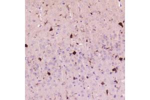 IHC analysis of Cystatin C using anti-Cystatin C antibody (ABIN5692829). (CST3 antibody  (AA 31-146))