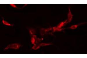 ABIN6278463 staining  Hela cells by IF/ICC. (FLT3 antibody  (C-Term))