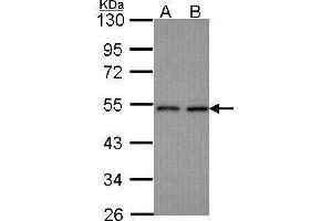 CLP1 antibody  (Center)