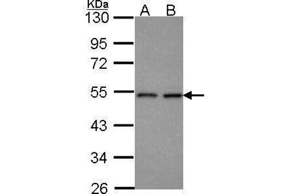 CLP1 Antikörper  (Center)