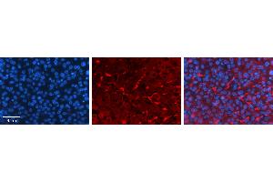 Rabbit Anti-GNS Antibody   Formalin Fixed Paraffin Embedded Tissue: Human Liver Tissue Observed Staining: Cytoplasm in Kupffer cells in sinusoids Primary Antibody Concentration: 1:100 Other Working Concentrations: N/A Secondary Antibody: Donkey anti-Rabbit-Cy3 Secondary Antibody Concentration: 1:200 Magnification: 20X Exposure Time: 0. (GNS antibody  (C-Term))