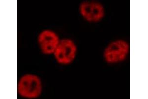ABIN6267014 staining Hela by IF/ICC. (CTBP1 antibody  (pSer422))