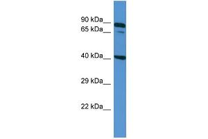 Host: Rabbit Target Name: ZDHHC11B Sample Type: NCI-H226 Whole cell lysates Antibody Dilution: 1. (ZDHHC11B antibody  (N-Term))