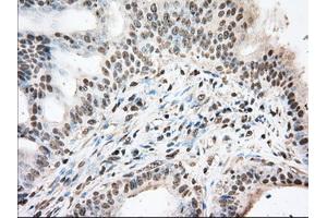Immunohistochemical staining of paraffin-embedded Human prostate tissue using anti-BAT1 mouse monoclonal antibody.