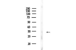 Western blot analysis of lysates from COLO205 cells(heat-shock,45 min treatment), using OR2 Antibody at 1/1000 dilution.