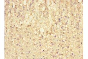 Immunohistochemistry of paraffin-embedded human adrenal gland tissue using ABIN7169723 at dilution of 1:100 (SIGIRR antibody  (AA 1-120))
