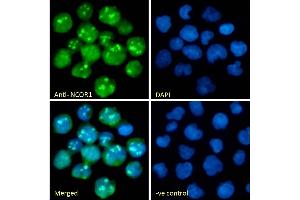 (ABIN7505820) Immunofluorescence analysis of paraformaldehyde fixed Jurkat cells, permeabilized with 0. (NCOR1 antibody)