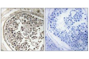 Immunohistochemistry analysis of paraffin-embedded human testis tissue using MRPS5 antibody. (MRPS5 antibody  (C-Term))