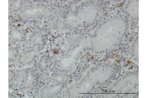 Immunoperoxidase of monoclonal antibody to FGL2 on formalin-fixed paraffin-embedded human stomach.