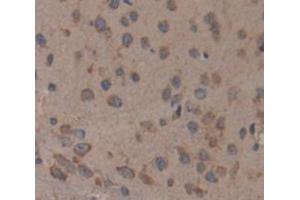 Used in DAB staining on fromalin fixed paraffin- embedded Kidney tissue (CELSR2 antibody  (AA 2589-2849))