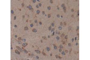 Used in DAB staining on fromalin fixed paraffin- embedded Kidney tissue