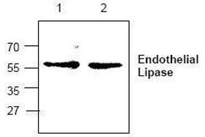 Image no. 1 for anti-Lipase, Endothelial (LIPG) antibody (ABIN127288) (LIPG antibody)