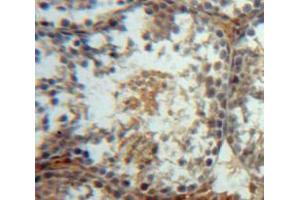 Used in DAB staining on fromalin fixed paraffin-embedded Testis tissue (WFDC2 antibody  (AA 30-124))