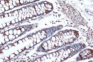 Immunohistochemistry of paraffin-embedded human colon using HSPE1/HSP10/HSPE1/HSP10/CPN10 Rabbit mAb (ABIN7267567) at dilution of 1:100 (40x lens). (HSPE1 antibody)