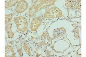 Immunohistochemistry of paraffin-embedded human kidney tissue using ABIN7156394 at dilution of 1:100 (INTS1 antibody  (AA 451-710))