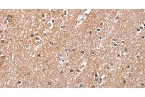 Immunohistochemistry of paraffin-embedded Human brain using RAB8A Polyclonal Antibody at dilution of 1:45 (RAB8A antibody)