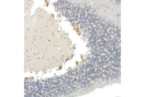 Immunohistochemistry of paraffin-embedded mouse brain using CNTN4 Rabbit mAb (ABIN7266495) at dilution of 1:100 (40x lens). (Contactin 4 antibody)