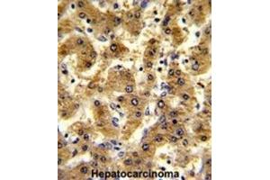 Immunohistochemistry (IHC) image for anti-Alcohol Dehydrogenase 1B (Class I), beta Polypeptide (ADH1B) antibody (ABIN3002782) (ADH1B antibody)