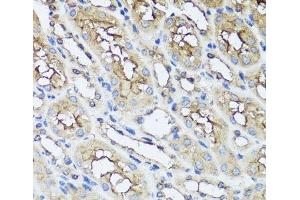 Immunohistochemistry of paraffin-embedded Mouse kidney using AIP Polyclonal Antibody at dilution of 1:100 (40x lens). (AIP antibody)