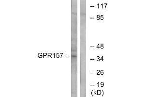 Western blot analysis of extracts from NIH-3T3 cells, using GPR157 antibody. (GPR157 antibody  (Internal Region))