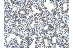 Image no. 1 for anti-Solute Carrier Family 43, Member 3 (SLC43A3) (N-Term) antibody (ABIN205016) (SLC43A3 antibody  (N-Term))