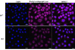 Immunocytochemical staining of HeLa cells using Prolyl endopeptidase like antibody (ABIN7799923), 1:1,000), Top panel: wild-type (WT), Bottom panal: Prolyl endopeptidase like shRNA knockdown (KD).