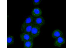 Immunofluorescence analysis of CRC cells using BAK1 antibody (ABIN5996915). (BAK1 antibody)