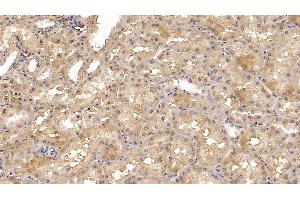 Detection of C1QBP in Human Kidney Tissue using Monoclonal Antibody to Complement component 1 Q subcomponent-binding protein, mitochondrial (C1QBP) (C1QBP antibody  (AA 76-282))