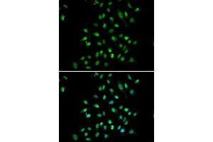 Immunofluorescence analysis of  cells using CXXC1 antibody (ABIN6130102, ABIN6139292, ABIN6139295 and ABIN6221504). (CXXC1 antibody  (AA 1-210))