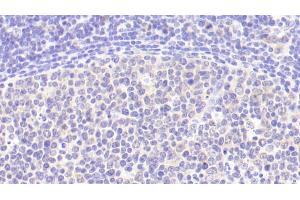 Detection of IL6 in Human Lymph node Tissue using Polyclonal Antibody to Interleukin 6 (IL6) (IL-6 antibody  (AA 29-212))