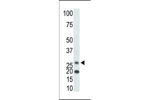 The anti-KHK Pab (ABIN391089 and ABIN2841230) is used in Western blot to detect KHK in mouse kidney tissue lysate. (Ketohexokinase antibody  (C-Term))