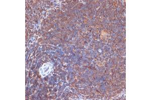Immunohistochemistry of paraffin-embedded rat spleen using PI3 Kinase p110 delta Rabbit mAb (ABIN7269326) at dilution of 1:100 (40x lens). (PIK3CD antibody)