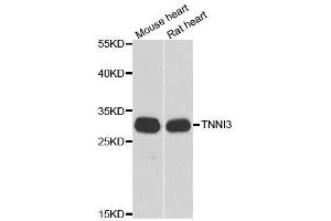 Western blot analysis of extracts of various cell lines, using TNNI3 antibody. (TNNI3 antibody  (AA 1-210))
