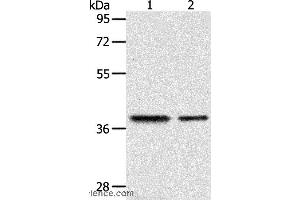 Western blot analysis of Human fetal kidney and fetal muscle tissue, using CNN3 Polyclonal Antibody at dilution of 1:400