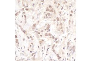 Immunohistochemistry (IHC) image for anti-Polymerase (DNA Directed), lambda (POLL) (AA 525-575) antibody (ABIN7454415) (POLL antibody  (AA 525-575))