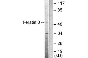 Western Blotting (WB) image for anti-Keratin 8 (KRT8) (C-Term) antibody (ABIN1848643) (KRT8 antibody  (C-Term))