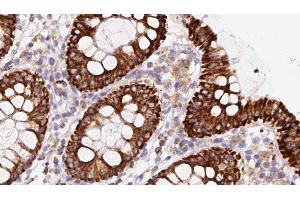 ABIN6279860 at 1/100 staining Mouse colon tissue by IHC-P. (STMN2 antibody  (Internal Region))