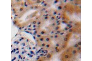 IHC-P analysis of Kidney tissue, with DAB staining. (VEGFA antibody  (AA 27-190))
