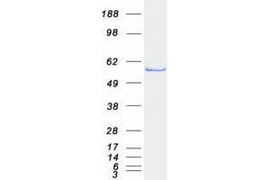 Western Blotting (WB) image for 4-Aminobutyrate Aminotransferase (ABAT) (Transcript Variant 2) protein (Myc-DYKDDDDK Tag) (ABIN2714259)