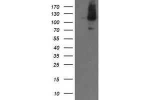 HEK293T cells were transfected with the pCMV6-ENTRY control (Left lane) or pCMV6-ENTRY ERCC4 (Right lane) cDNA for 48 hrs and lysed. (ERCC4 antibody)