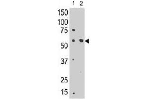 The SIGLEC8 polyclonal antibody  is used in Western blot to detect SIGLEC8 in mouse liver tissue lysate (lnae 1) and in HL-60 cell lysate (lane 2) . (SIGLEC8 antibody  (C-Term))