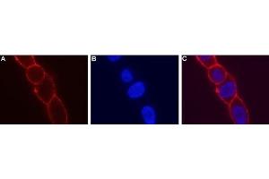 Expression of KCNN4 in live LN-CaP cells - Cell surface detection of KCNN4 in live intact human LNCaP prostate carcinoma cells.