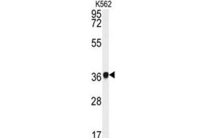 Western Blotting (WB) image for anti-Neutrophil Cytosolic Factor 4, 40kDa (NCF4) antibody (ABIN3003340) (NCF4 antibody)