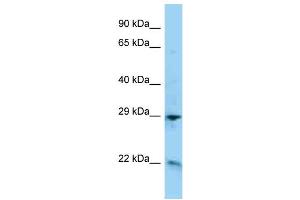 WB Suggested Anti-ADM Antibody Titration: 1. (Adrenomedullin antibody  (C-Term))