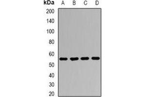 Western blot analysis of AGFG1 expression in Jurkat (A), HepG2 (B), mouse lung (C), mouse testis (D) whole cell lysates.