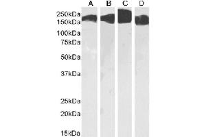 Western Blot using anti-CD171 antibody L1-14.