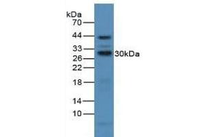 Figure. (CD25 antibody  (AA 22-213))