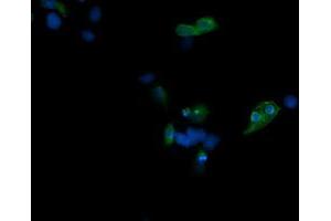Immunofluorescence (IF) image for anti-T-cell surface glycoprotein CD1c (CD1C) antibody (ABIN2670659) (CD1c antibody)