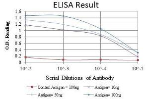 Red: Control Antigen (100 ng), Purple: Antigen (10 ng), Green: Antigen (50 ng), Blue: Antigen (100 ng), (GCK antibody)